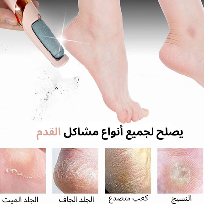 Electric Pedicure Callus Remover – Smooth Feet, Effortlessly