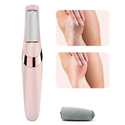 Electric Pedicure Callus Remover – Smooth Feet, Effortlessly